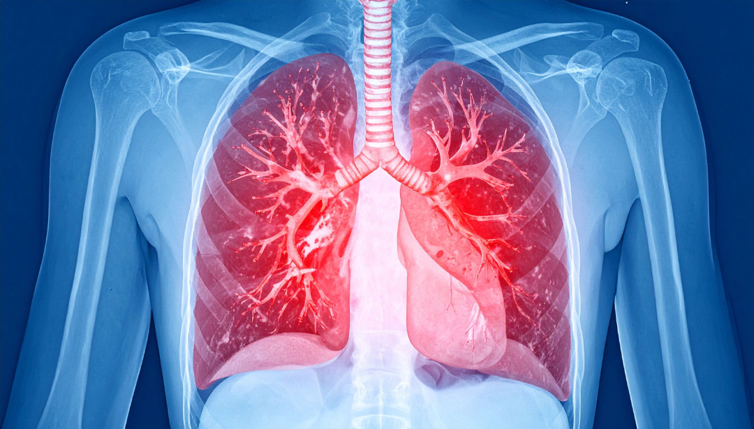 pulmones